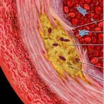 Cholesterol